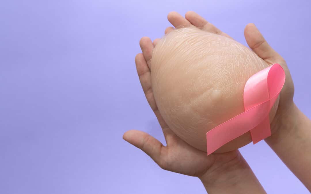 Prosthetics: An Alternative To Reconstruction